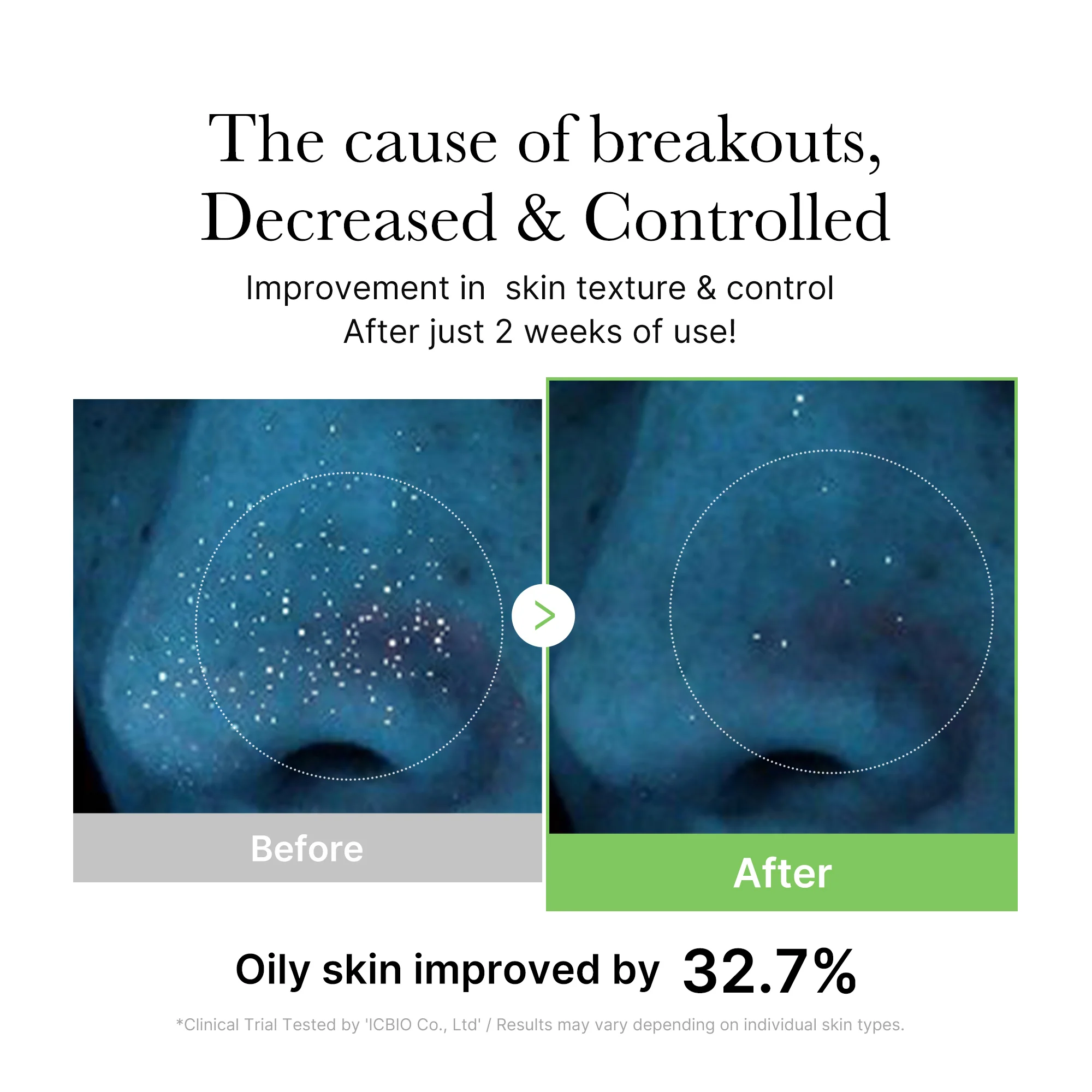 [GIFT] Exosome Cica Calming Toner - Image 4