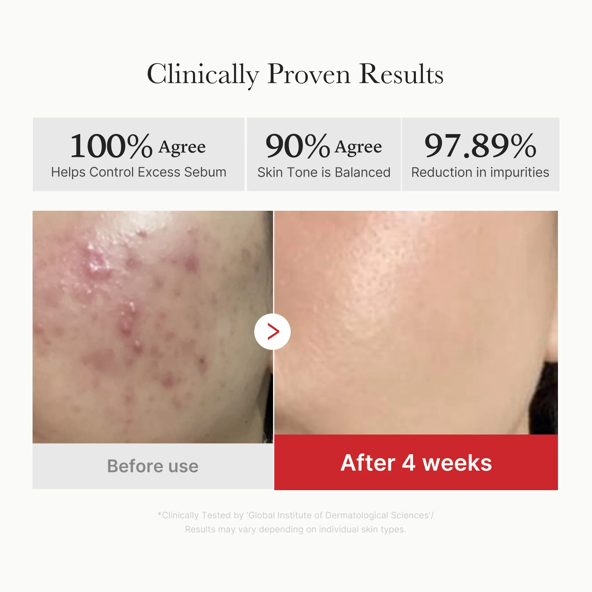[GIFT] Red Succinic Acid Panthenol Pads - Image 4