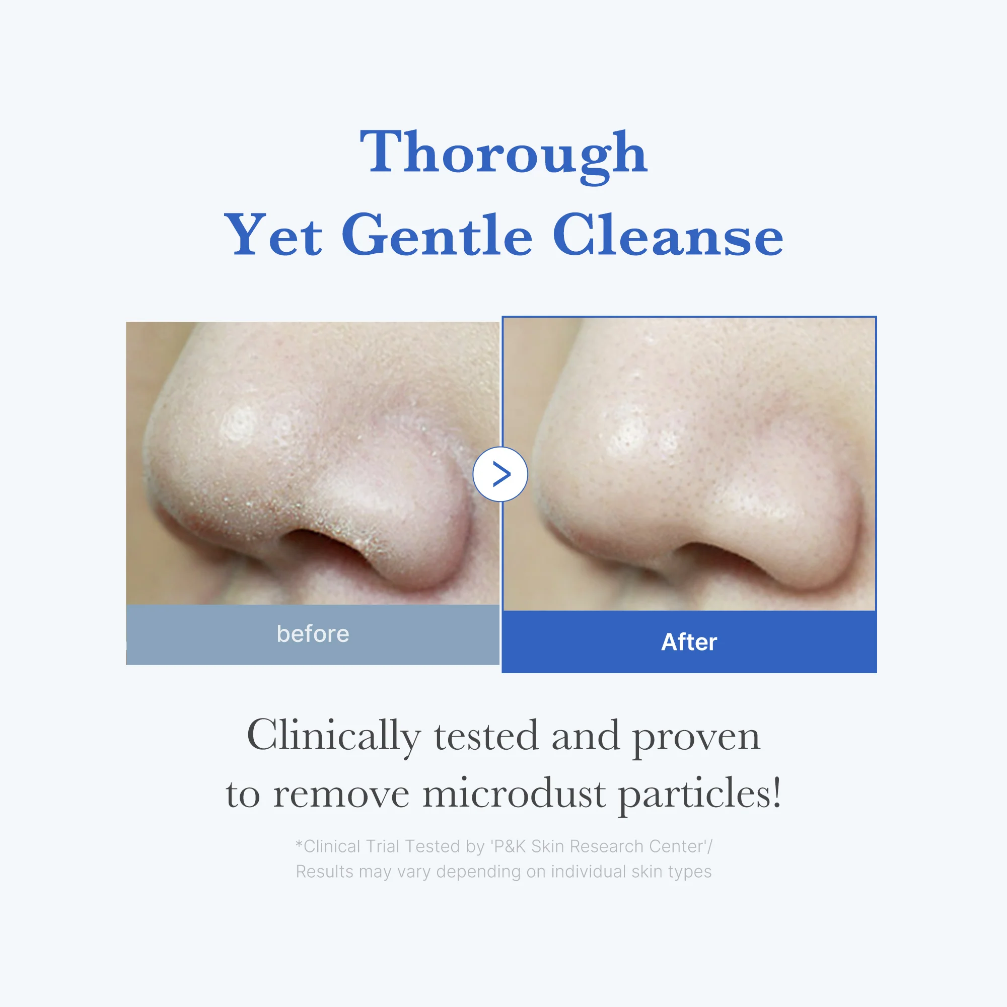 [GIFT] Zero Foam Cleanser - Image 3