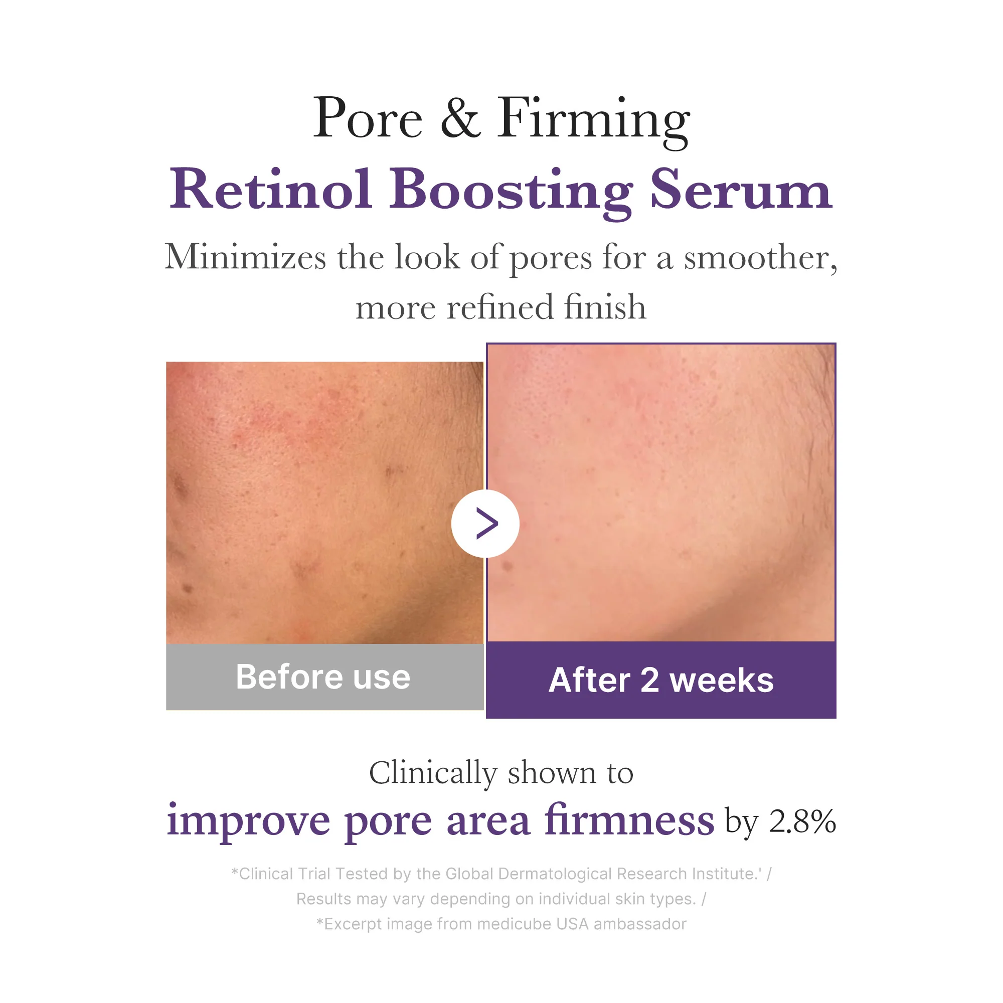 [Subscr.] Retinol NMN Boosting Serum - Image 4