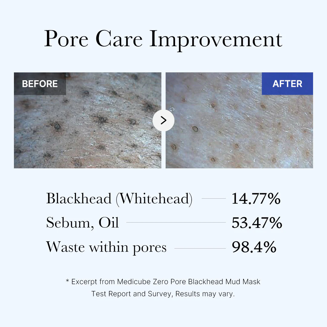[Subscr.] Zero Pore Blackhead Mud Mask - Image 5