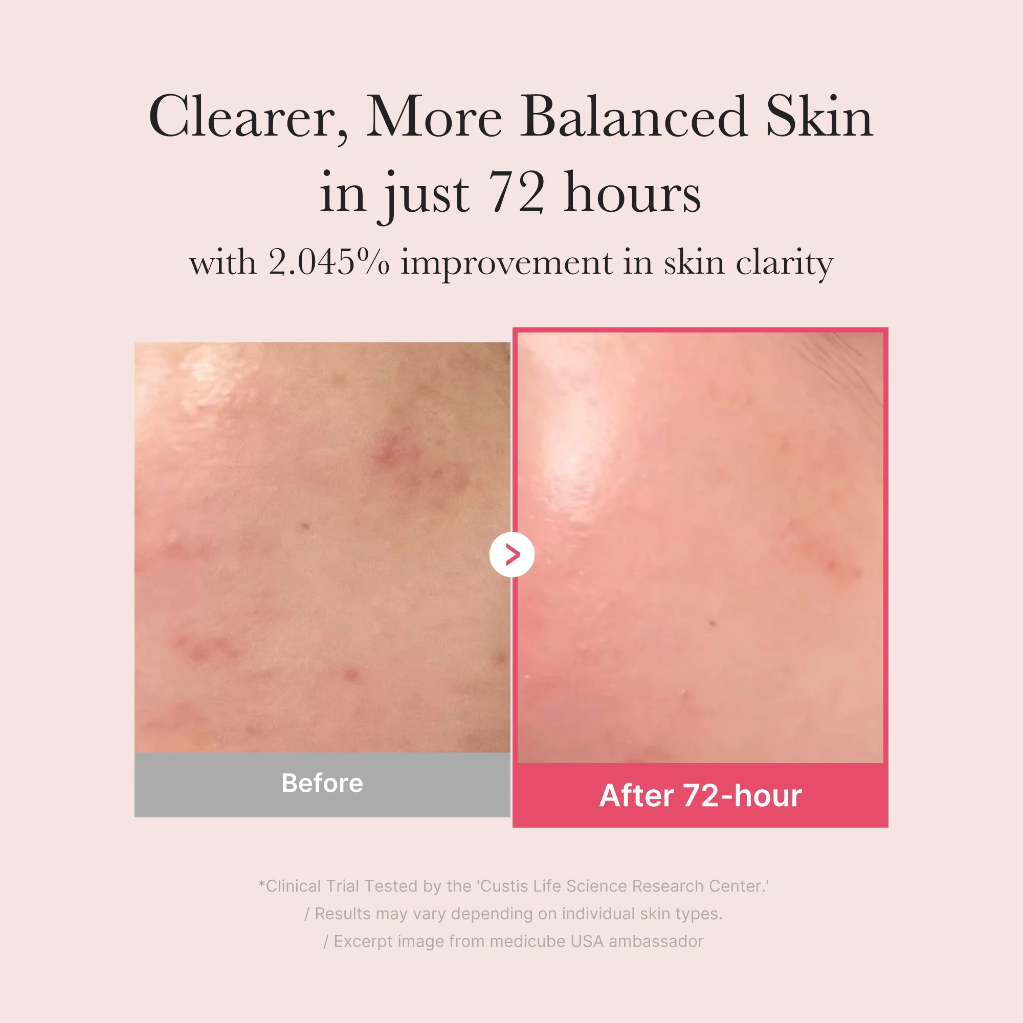 TXA Niacinamide Serum - Image 3